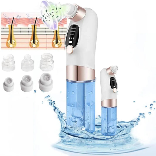 hydro facial vacuum removing dirt and blackheads from skin pores