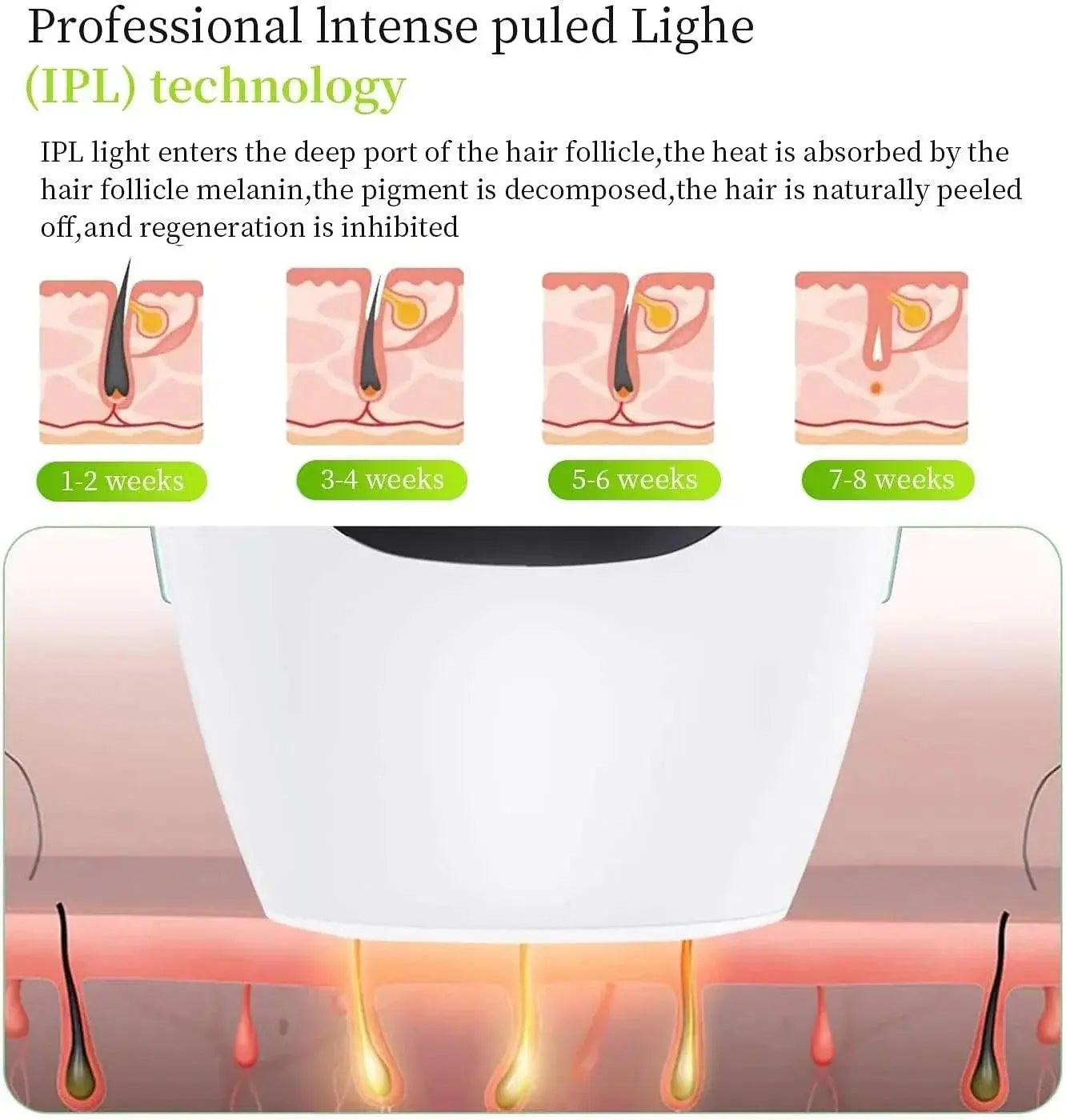 Close-up of the IPL treatment window showing different intensity levels for skin safety and comfort.